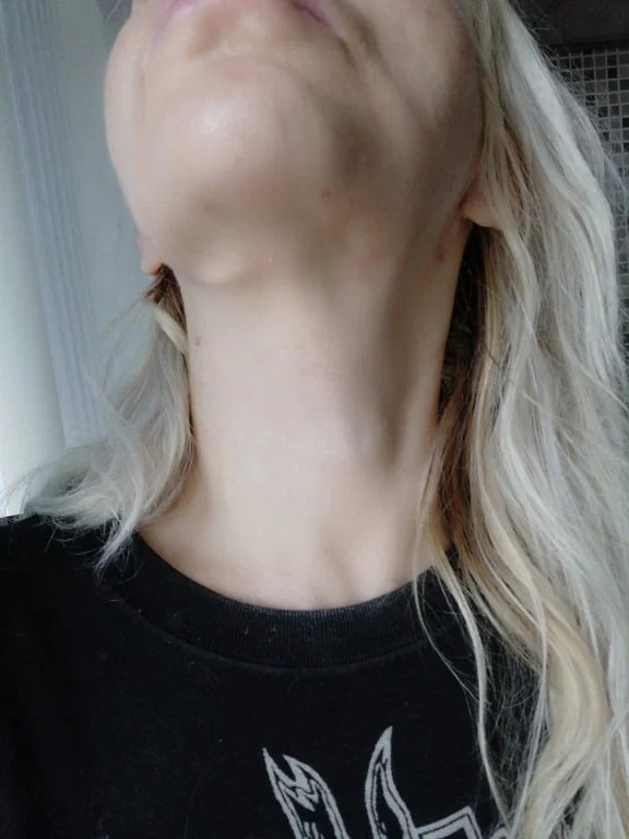 Клиника эстетической медицины и косметологии FaceLifting - faceliftingmsk отвратительный результат обман