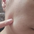Крем-сыворотка FLEXYRAZOL