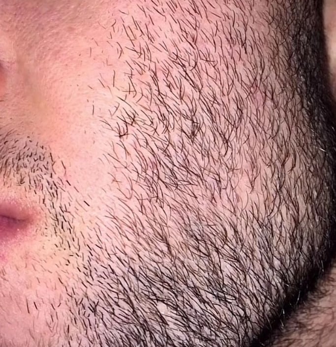 Сыворотка для роста волос D'umor Hair for men - Лучшее средство за адекватную цену