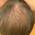 Отзыв о Сыворотка для роста волос D'umor Hair for men: Прощай лысина