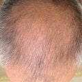 Отзыв о Сыворотка для роста волос D'umor Hair for men: Парни у кого проблемы с волосами не проходите мимо.