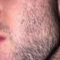 Отзыв о Сыворотка для роста волос D'umor Hair for men: Лучшее средство за адекватную цену