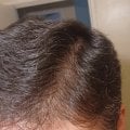 Отзыв о Сыворотка для роста волос D'umor Hair for men: Потеря волос не проблема