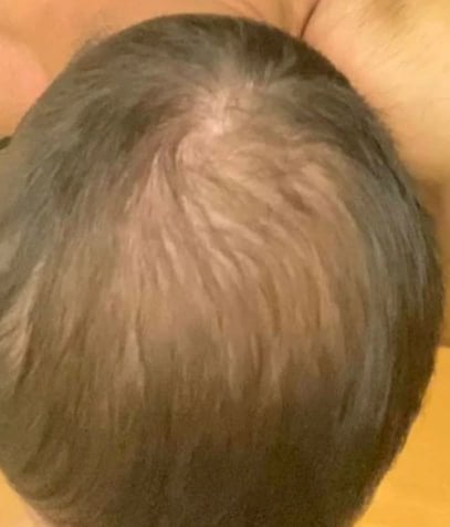Сыворотка для роста волос D'umor Hair for men - Прощай лысина