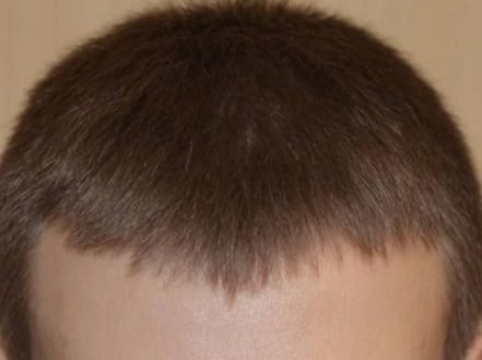 Сыворотка для роста волос D'umor Hair for men - Прощай лысина
