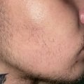 Отзыв о Сыворотка для роста волос D'umor Hair for men: Преображение моей редкой щетины🕵️♂️