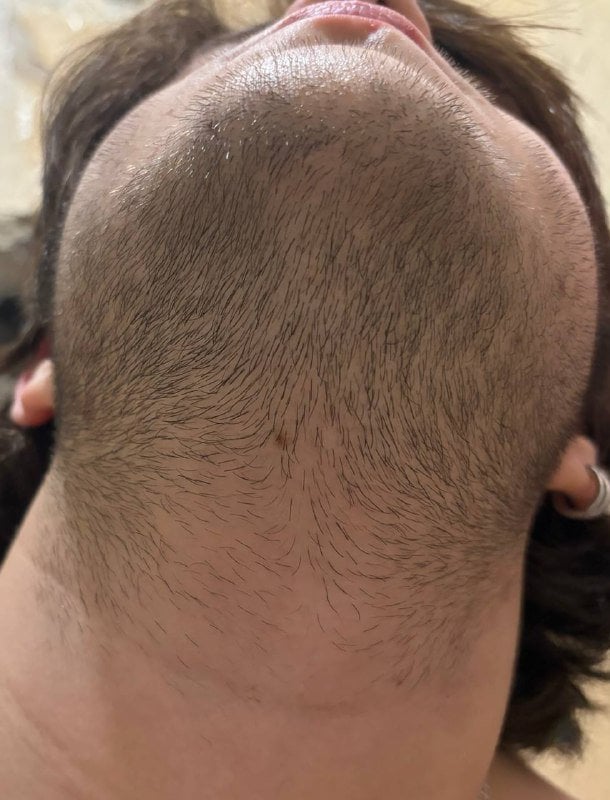 Сыворотка для роста волос D'umor Hair for men - Лучшее что пробовал ну и результативнее аналогов