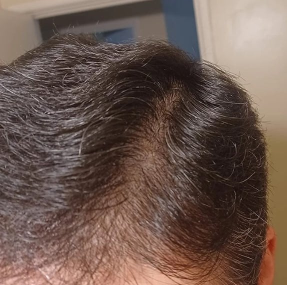 Сыворотка для роста волос D'umor Hair for men - Потеря волос не проблема