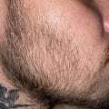 Отзыв о Сыворотка для роста волос D'umor Hair for men: Преображение моей редкой щетины🕵️♂️