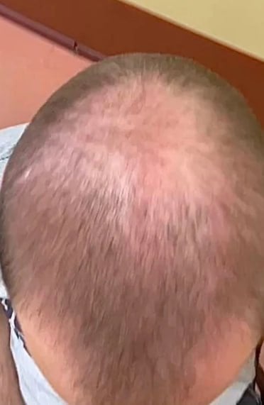 Сыворотка для роста волос D'umor Hair for men - Прощай лысина