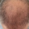 Отзыв о Сыворотка для роста волос D'umor Hair for men: Парни у кого проблемы с волосами не проходите мимо.