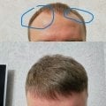 Помогает реально, не чудо но работает.